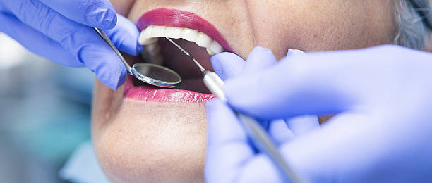 Best Pediatric Emergency Dentist in Burlingame, CA